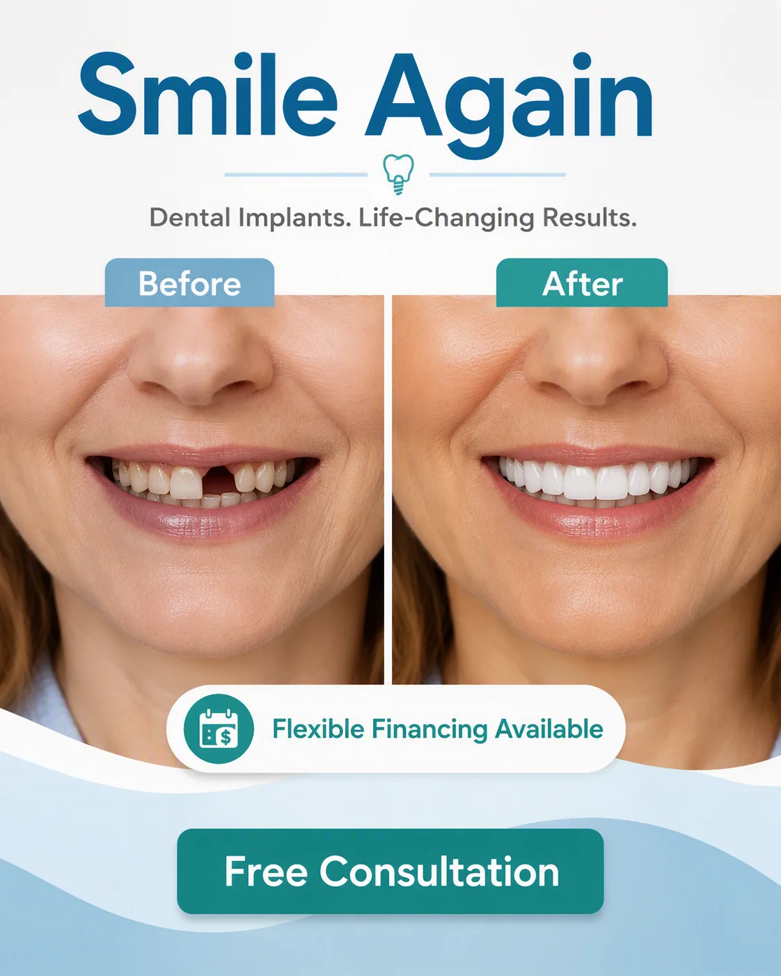 Smile Again Dental Implants Facebook Ad